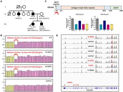 New Structural and Single Nucleotide Mutations in Type I and Type II Collagens in Taiwanese Children With Type I and Type II Collagenopathies